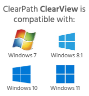 ClearView compatibility